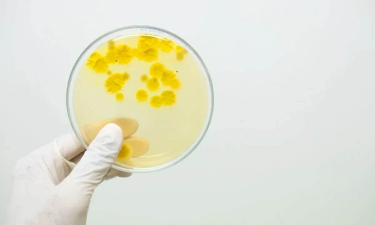 Liczne bakterie w moczu: Kiedy to problem? Interpretacja i leczenie