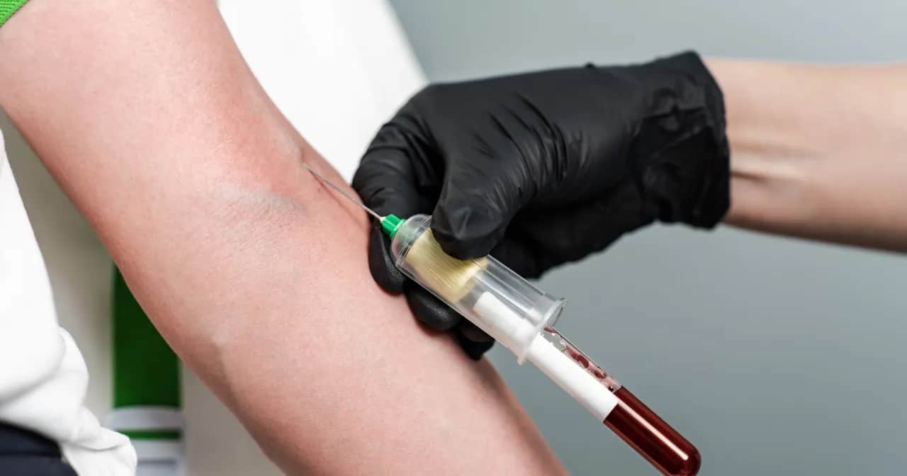 Wysoka ferrytyna: przyczyny, objawy nadmiaru żelaza. Kiedy do lekarza?